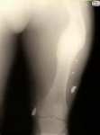 X-Ray